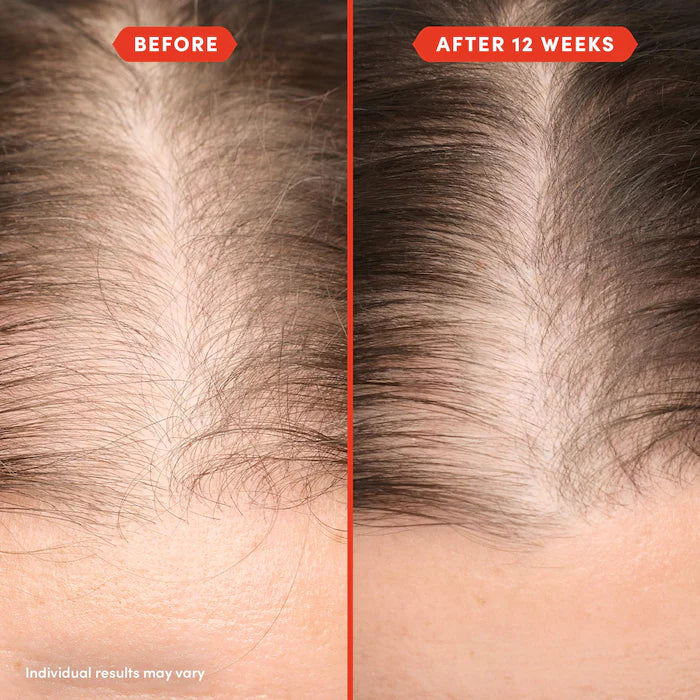 HoliRoots™: El Aceite Pre-Lavado para un Cuero Cabelludo Sano y un Cabello Radiante